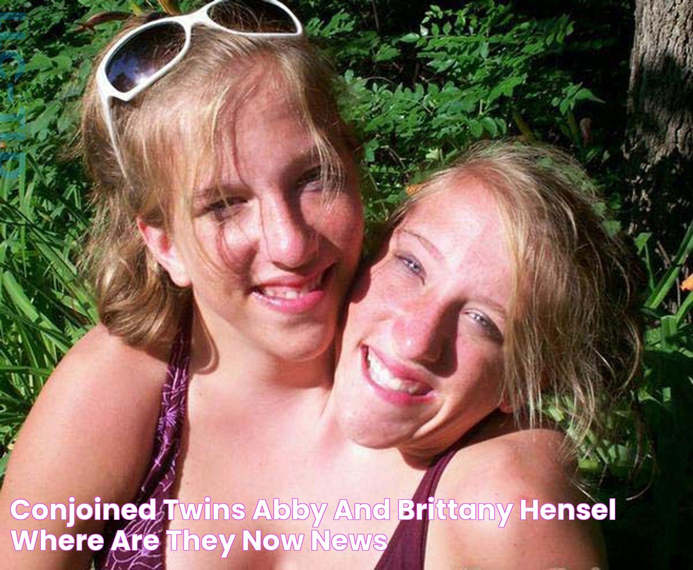 Conjoined Twins Abby and Brittany Hensel, Where are they Now? News