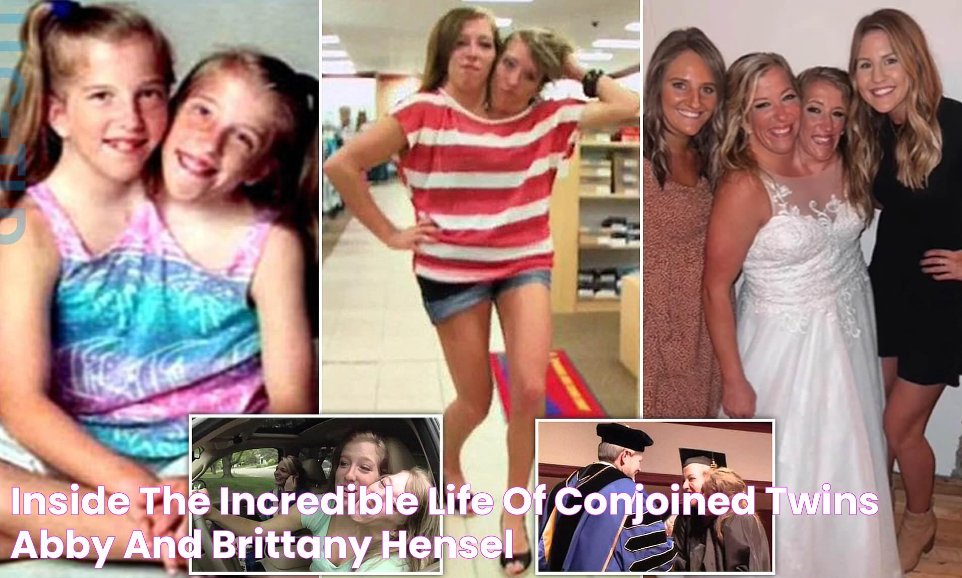 Inside the incredible life of conjoined twins Abby and Brittany Hensel