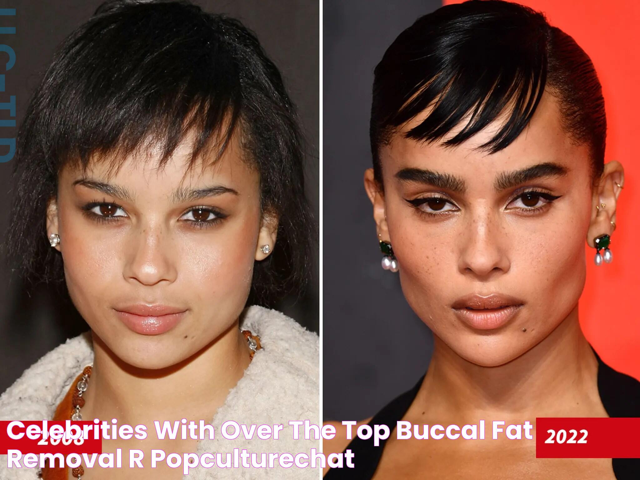 Celebrities with over the top buccal fat removal r/popculturechat