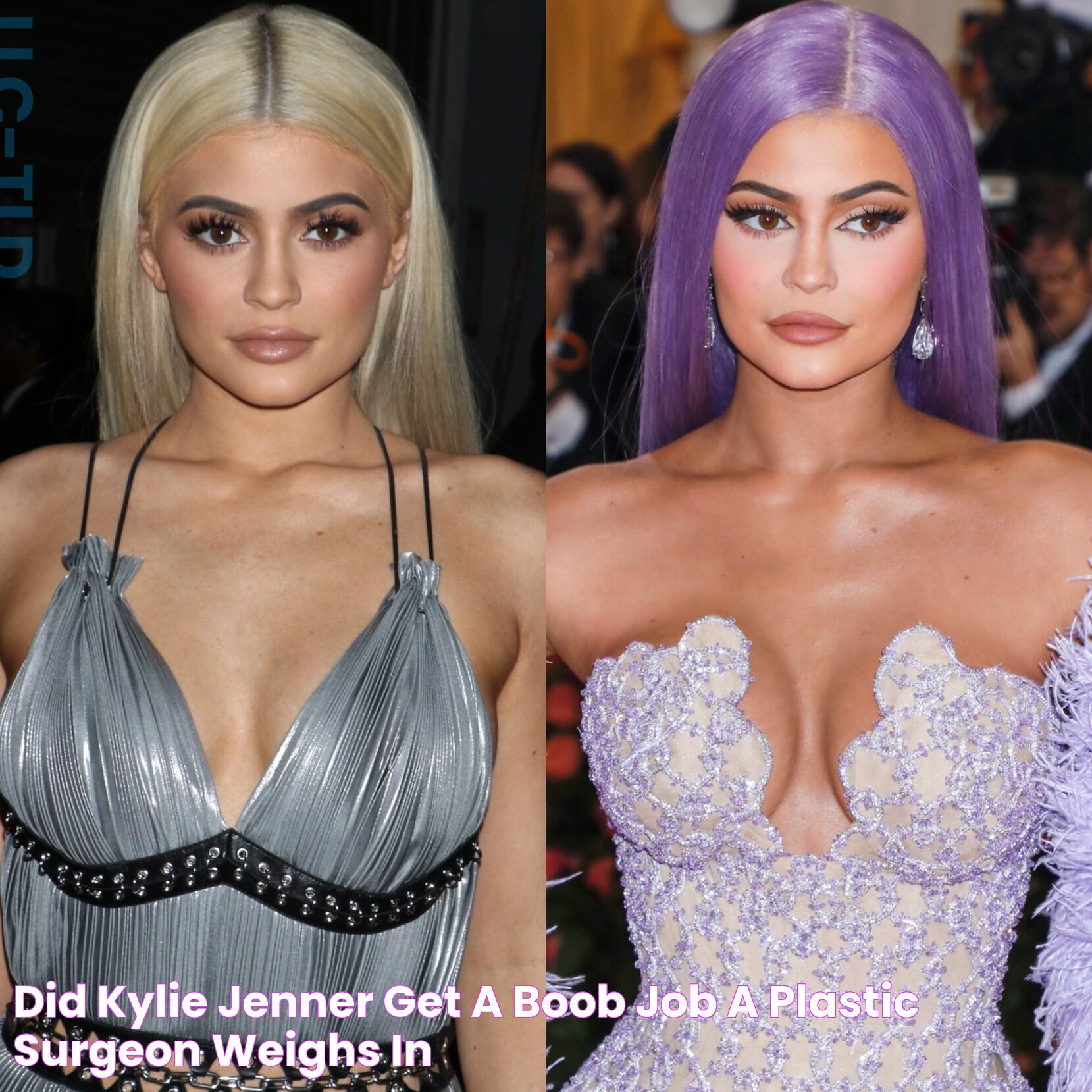 Did Kylie Jenner Get a Boob Job? A Plastic Surgeon Weighs In