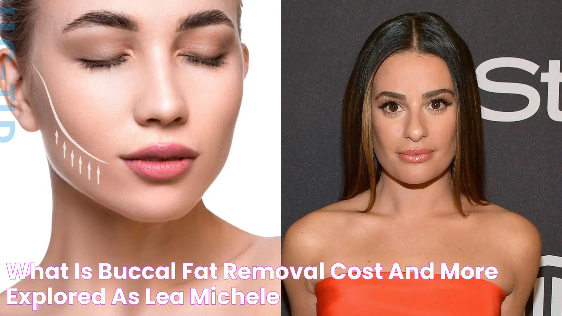 What is Buccal Fat removal? Cost and more explored as Lea Michele