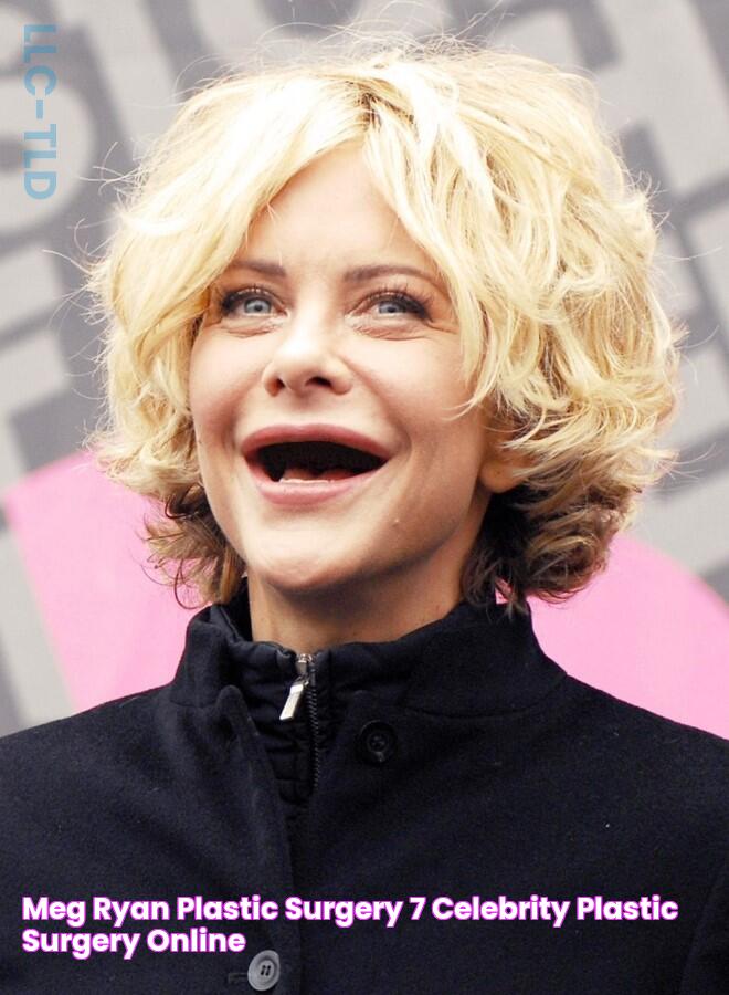 Meg Ryan plastic surgery (7) Celebrity plastic surgery online