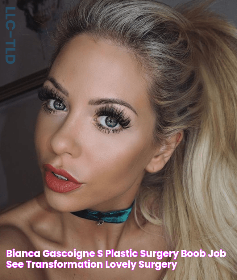 Bianca Gascoigne's Plastic Surgery (Boob Job) See Transformation Lovely Surgery