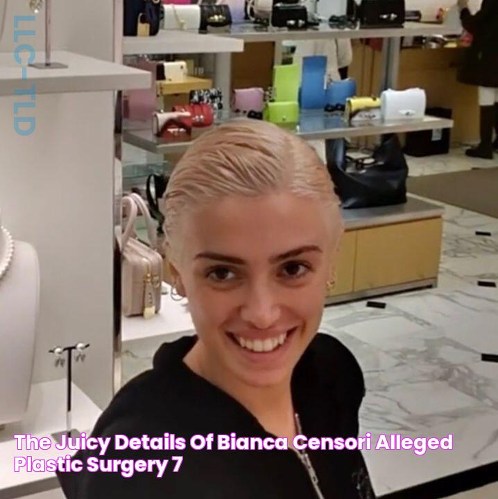 The Juicy Details of Bianca Censori Alleged Plastic Surgery